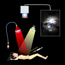 diagram of person undergoing surgery aided by imaging system