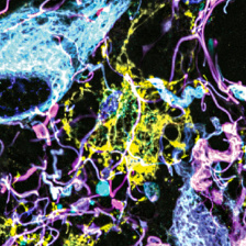 colorful, squiggly brain tissue on a black background