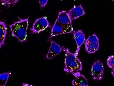 microscopic image of ovarian cells dotted with nanoparticles